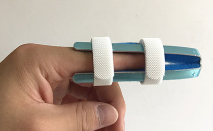 鋁合金指骨板 鋁合金指骨板